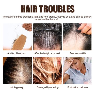 EELHOE Intense Hair Serum Moisturizing Hair Repair Hair Root Thickening Hairline Strengthening Hair Treatment.